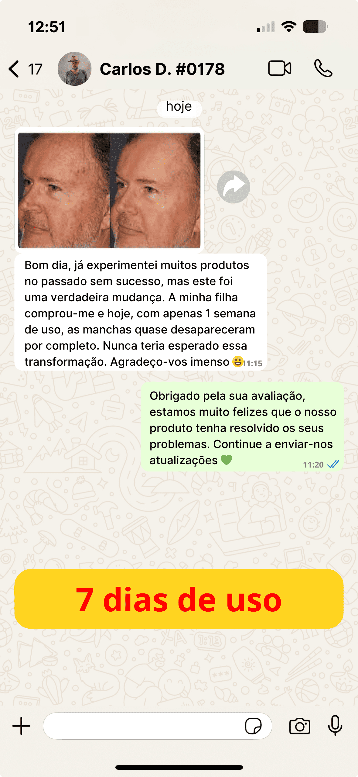 Antiage