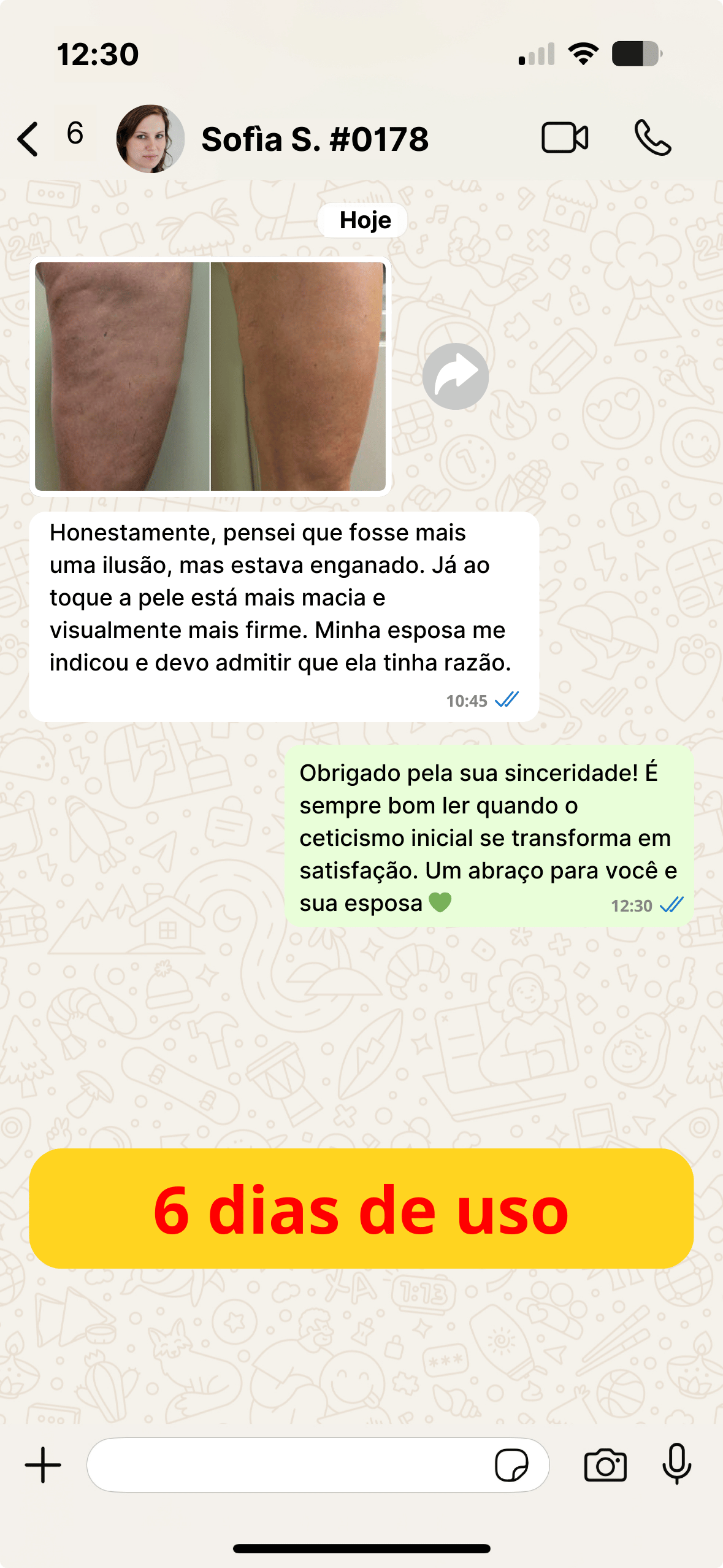 Cellulite PT (5)